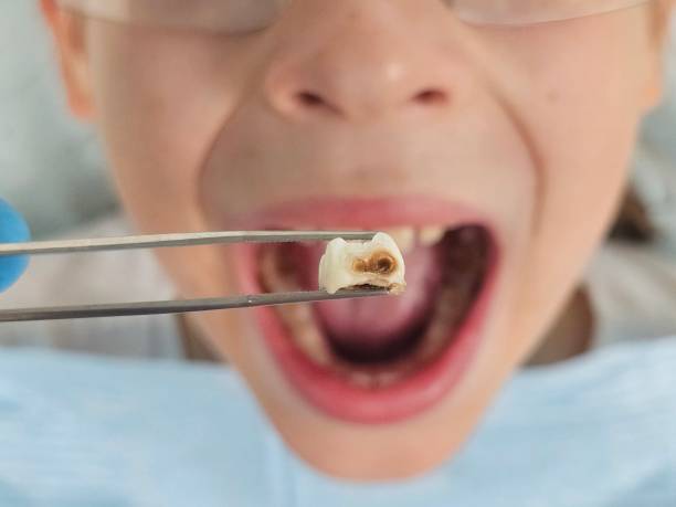 Best Walk-In Emergency Dentist in St Hedwig, TX
